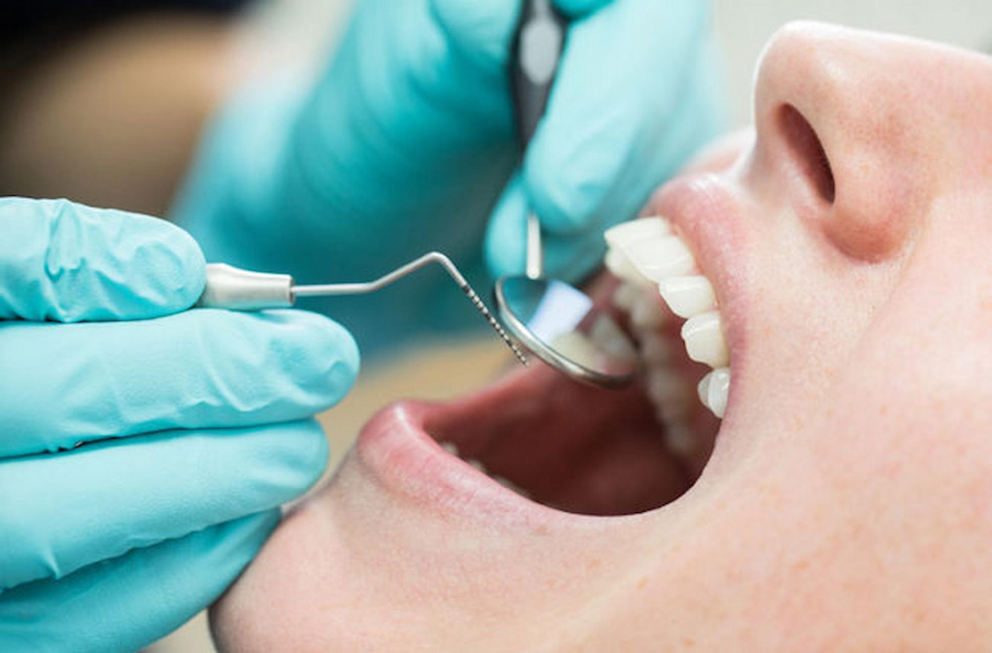 Tips To Find The Right Dentist For Dental Problems