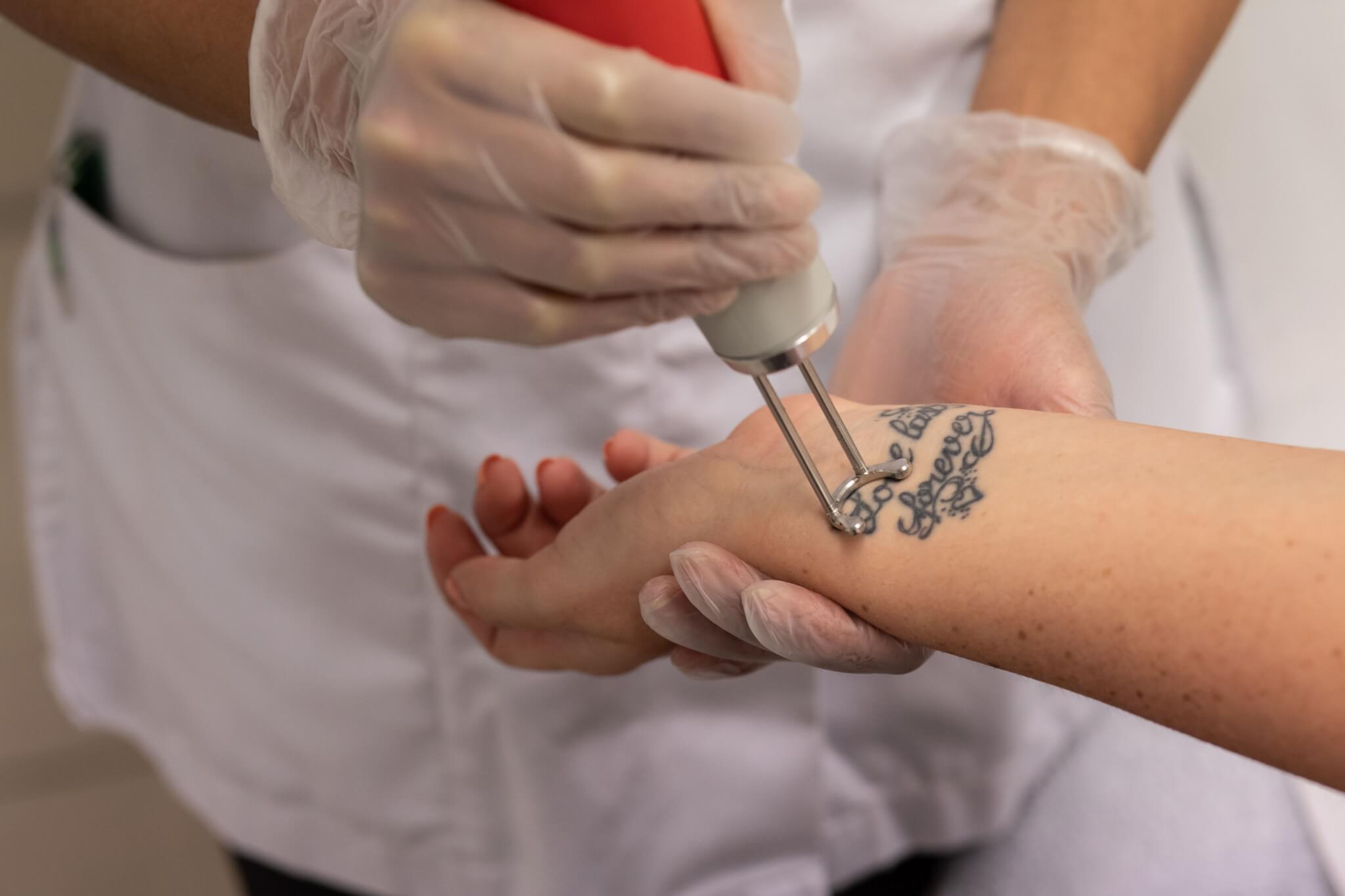 Is Tattoo Removal The Right Option For Me?